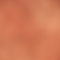 The Super Macro Bros.